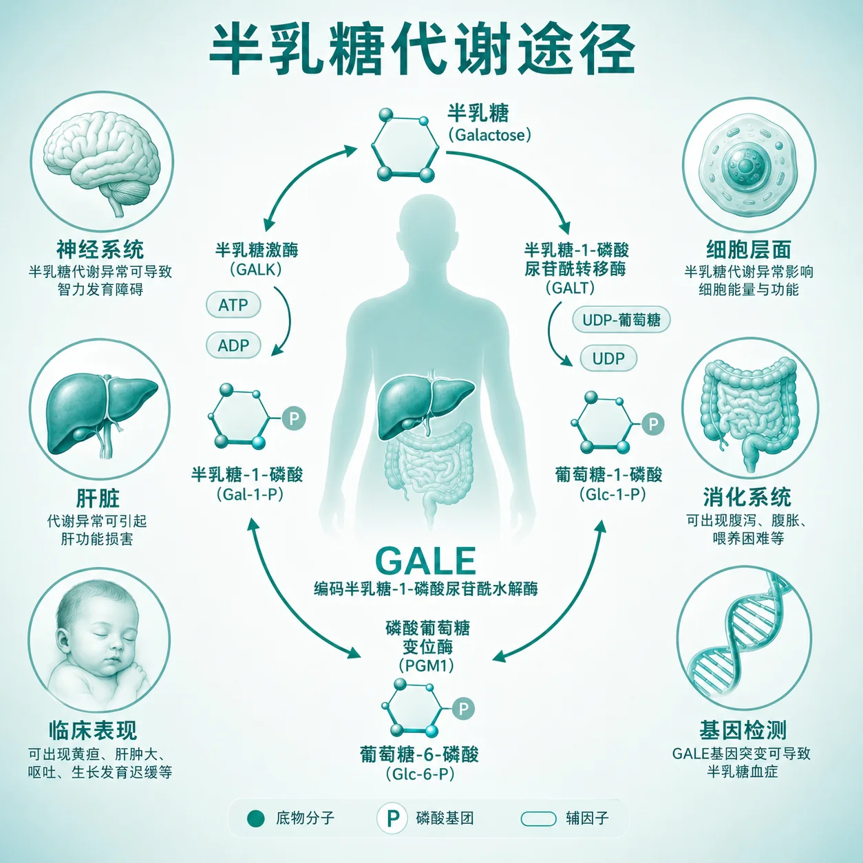 差向异构酶缺乏性半乳糖血症 - 半乳糖代谢通路示意图
