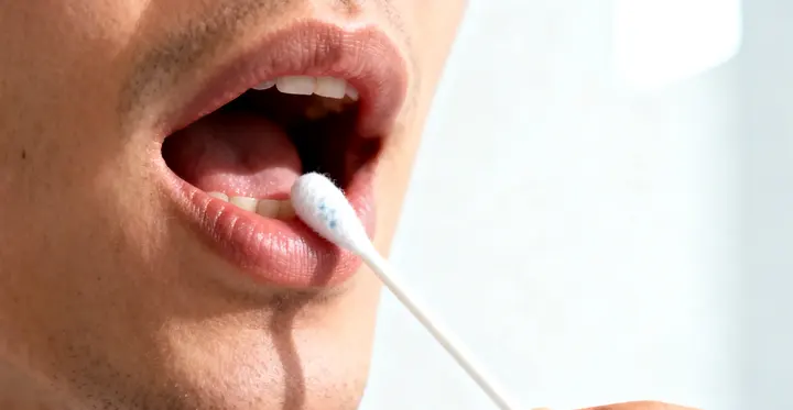 赤峰亲子鉴定口腔拭子采样