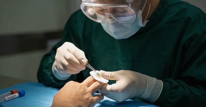 伊吾亲子鉴定采样