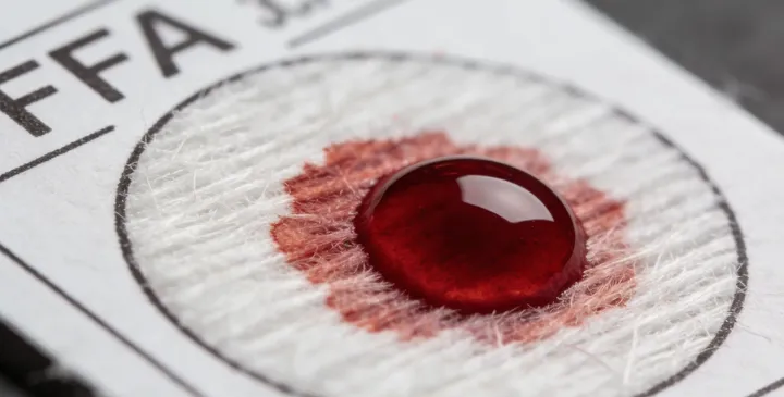 开封龙亭亲子鉴定样本采集 开封龙亭亲子鉴定样本采集