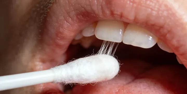 尼勒克亲子鉴定样本采集