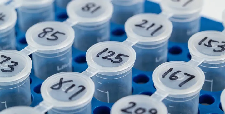 乌鲁木齐亲子鉴定实验室设备