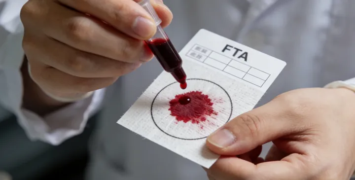 宿松亲子鉴定采样现场