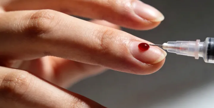 大庆大同司法亲子鉴定采样