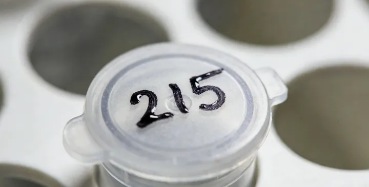 平邑亲子鉴定样本采集 平邑亲子鉴定样本采集