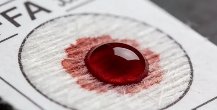 铜鼓亲子鉴定样本采集