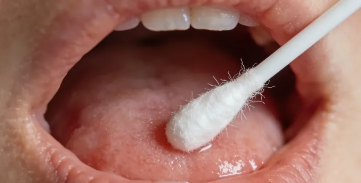 郑州亲子鉴定采样示意图 郑州亲子鉴定采样示意图