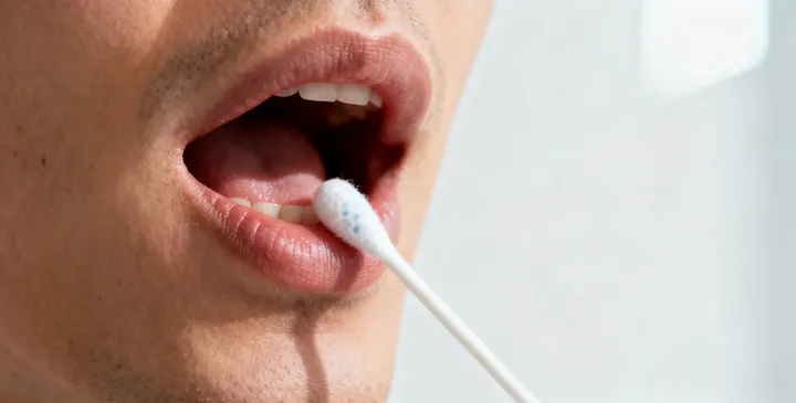 策勒无创亲子鉴定采样过程