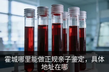 霍城哪里能做正规亲子鉴定，具体地址在哪